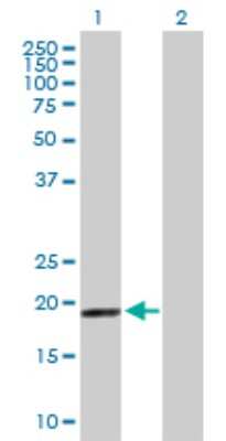 Western Blot: MRPS28 Antibody [H00028957-B01P]