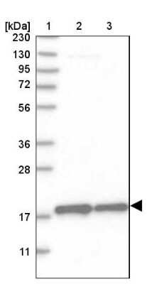 Western Blot: MRPS28 Antibody [NBP1-81685]