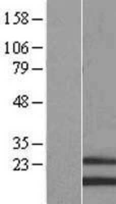 Western Blot: MRPS28 Overexpression Lysate [NBL1-13299]