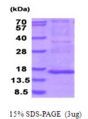 SDS-PAGE: Recombinant Human MRPS28 His Protein [NBP2-51943]