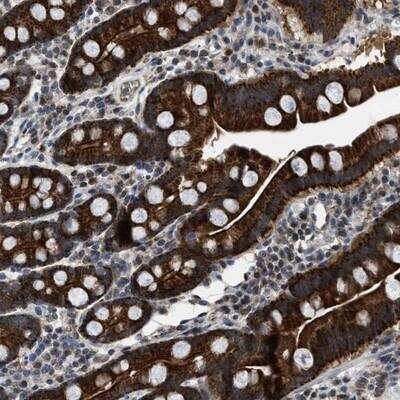 Immunohistochemistry: MRPS30 Antibody [NBP1-87344]