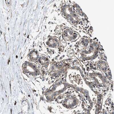 Immunohistochemistry-Paraffin: MRPS30 Antibody [NBP1-87343]