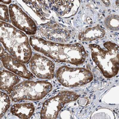 Immunohistochemistry-Paraffin: MRPS30 Antibody [NBP1-87343]