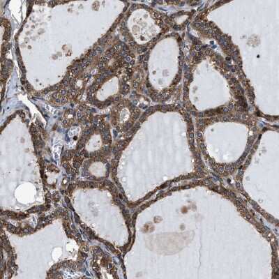 Immunohistochemistry-Paraffin: MRPS30 Antibody [NBP1-87343]