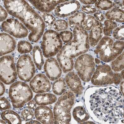 Immunohistochemistry-Paraffin: MRPS30 Antibody [NBP1-87344]