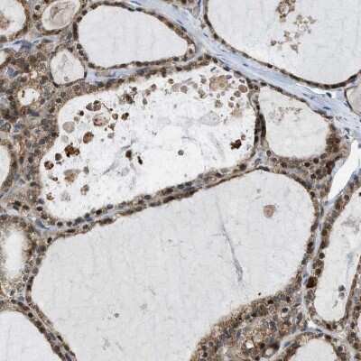 Immunohistochemistry-Paraffin: MRPS30 Antibody [NBP1-87344]