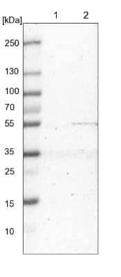 Western Blot: MRPS30 Antibody [NBP1-87343]