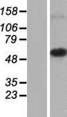 Western Blot: MRPS30 Overexpression Lysate [NBP2-06991]