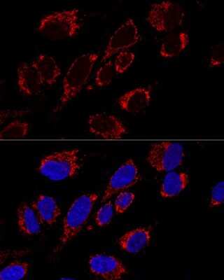 Immunocytochemistry/ Immunofluorescence: MRPS31 Antibody - Azide and BSA Free [NBP2-93779]