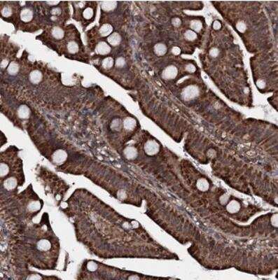 Immunohistochemistry: MRPS31 Antibody [NBP2-30559]