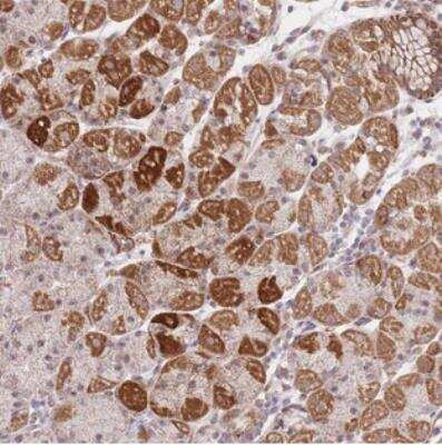 Immunohistochemistry-Paraffin: MRPS31 Antibody [NBP2-30923]