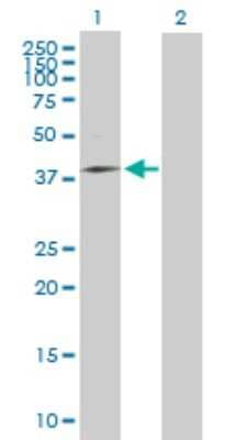 Western Blot: MRPS31 Antibody [H00010240-B01P]