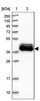 Western Blot: MRPS31 Antibody [NBP2-30559]