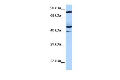 Western Blot: MRPS31 Antibody [NBP2-87838]