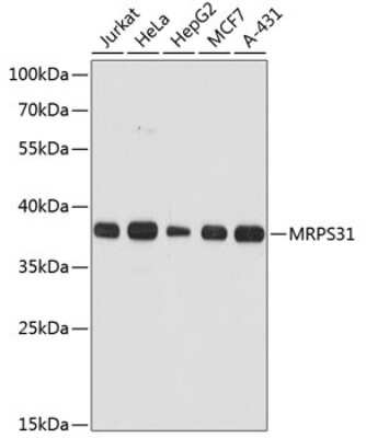 Western Blot: MRPS31 AntibodyAzide and BSA Free [NBP2-93779]