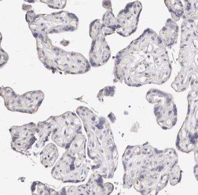 Immunohistochemistry-Paraffin: MRPS33 Antibody [NBP1-84517]