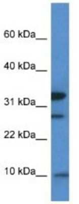 Western Blot: MRPS33 Antibody [NBP1-74120]