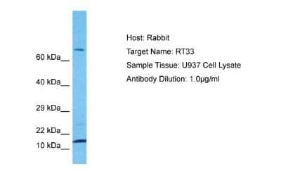 Western Blot: MRPS33 Antibody [NBP2-85326]