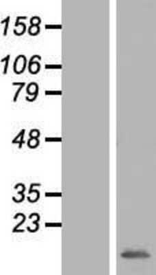 Western Blot: MRPS33 Overexpression Lysate [NBL1-13302]