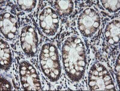 Immunohistochemistry: MRPS34 Antibody (OTI4H2) [NBP2-45432]