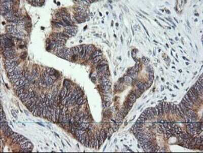 Immunohistochemistry: MRPS34 Antibody (OTI4H2) [NBP2-45432]