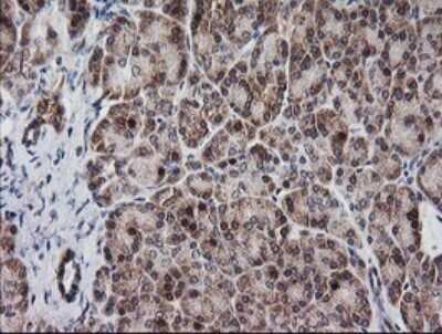 Immunohistochemistry: MRPS34 Antibody (OTI4H2) [NBP2-45432]