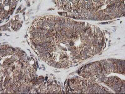 Immunohistochemistry: MRPS34 Antibody (OTI4H2) [NBP2-45432]