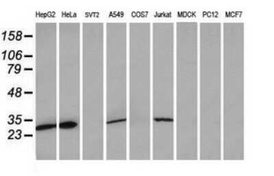 Western Blot: MRPS34 Antibody (OTI4H2) [NBP2-45432]