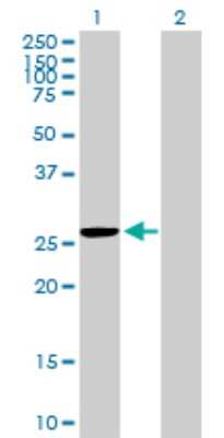 Western Blot: MRPS35 Antibody [H00060488-B01P]