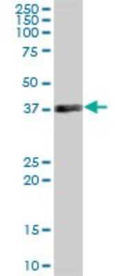 Western Blot: MRPS35 Antibody [H00060488-B02P]