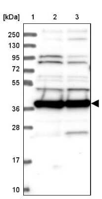 Western Blot: MRPS35 Antibody [NBP1-82786]