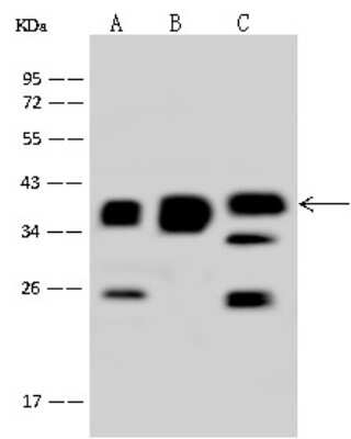 Western Blot: MRPS35 Antibody [NBP2-98524]