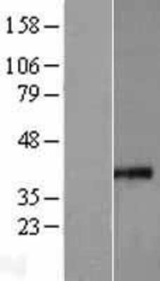 Western Blot: MRPS35 Overexpression Lysate [NBL1-13304]