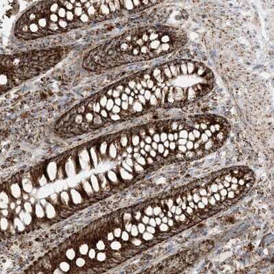 Immunohistochemistry-Paraffin: MRPS36 Antibody [NBP1-85286]