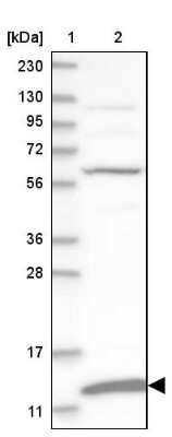 Western Blot: MRPS36 Antibody [NBP1-85286]