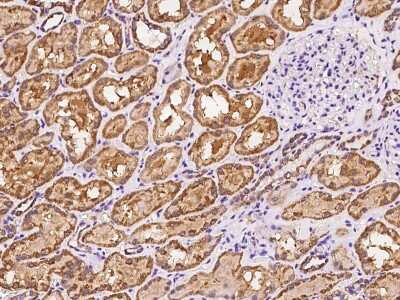 Immunohistochemistry-Paraffin: MRPS5 Antibody [NBP2-98525]