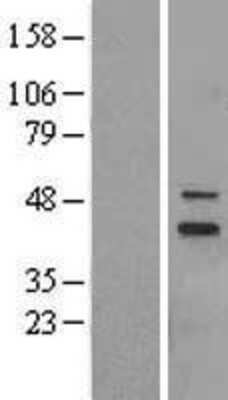 Western Blot: MRPS5 Overexpression Lysate [NBL1-13306]