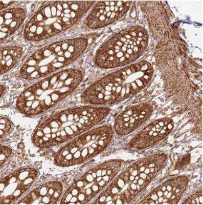 Immunohistochemistry: MRPS6 Antibody [NBP2-30508]