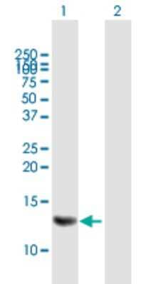 Western Blot: MRPS6 Antibody [H00064968-B01P]