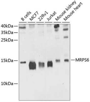 Western Blot: MRPS6 AntibodyBSA Free [NBP2-93563]