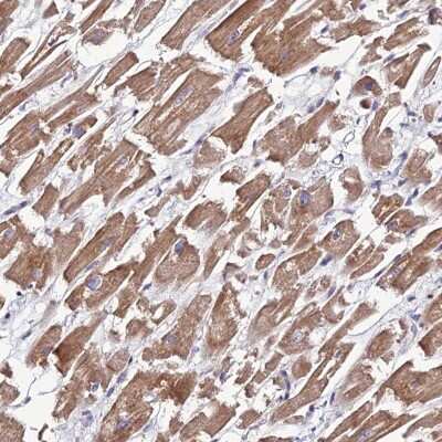 Immunohistochemistry-Paraffin: MRPS9 Antibody [NBP2-30501]