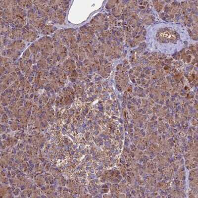 Immunohistochemistry-Paraffin: MRPS9 Antibody [NBP2-30501]