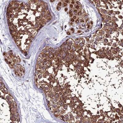 Immunohistochemistry-Paraffin: MRPS9 Antibody [NBP2-30501]