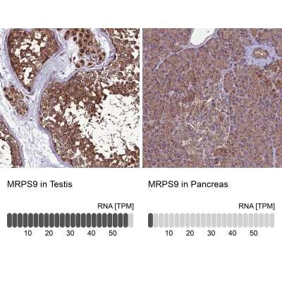 Immunohistochemistry-Paraffin: MRPS9 Antibody [NBP2-30501]