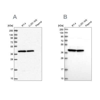 Western Blot: MRPS9 Antibody [NBP2-30429]