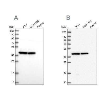 Western Blot: MRPS9 Antibody [NBP2-30501]