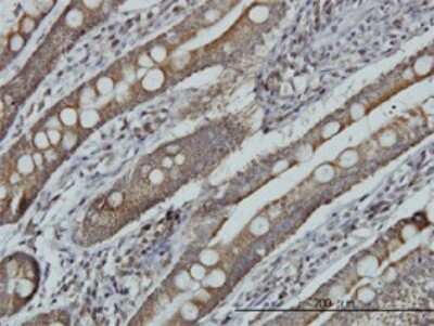 Immunohistochemistry-Paraffin: MRRF Antibody (1D3) [H00092399-M01]