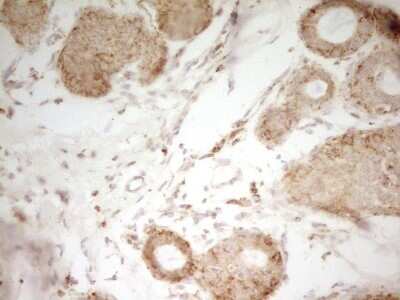 Immunohistochemistry: MRRF Antibody (OTI1D5) [NBP2-45434]