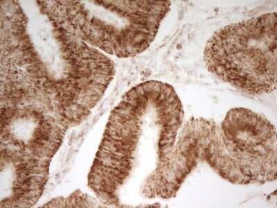 Immunohistochemistry: MRRF Antibody (OTI1D5) [NBP2-45434]