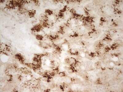 Immunohistochemistry: MRRF Antibody (OTI1D5) [NBP2-45434]